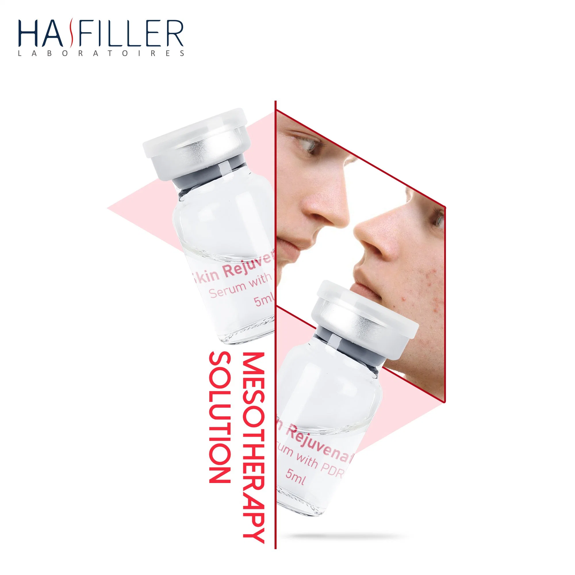 High quality/High cost performance Repair Skin Sun Damage Skin Rejuvenating Serum Pdrn Injection Mesotherapy Serum