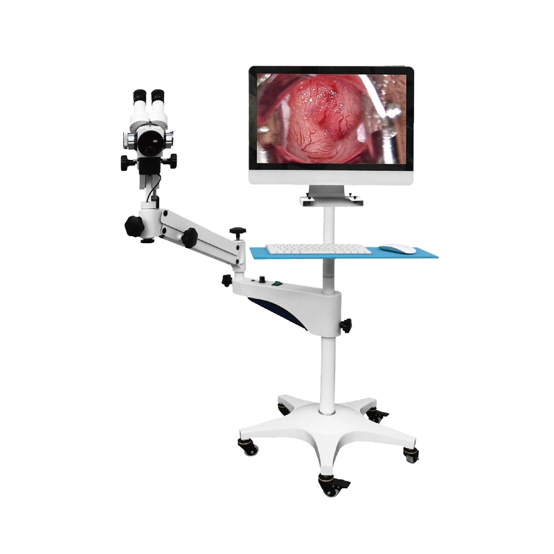 Gynecological Colposcopy Machine Equipment Set with Camera