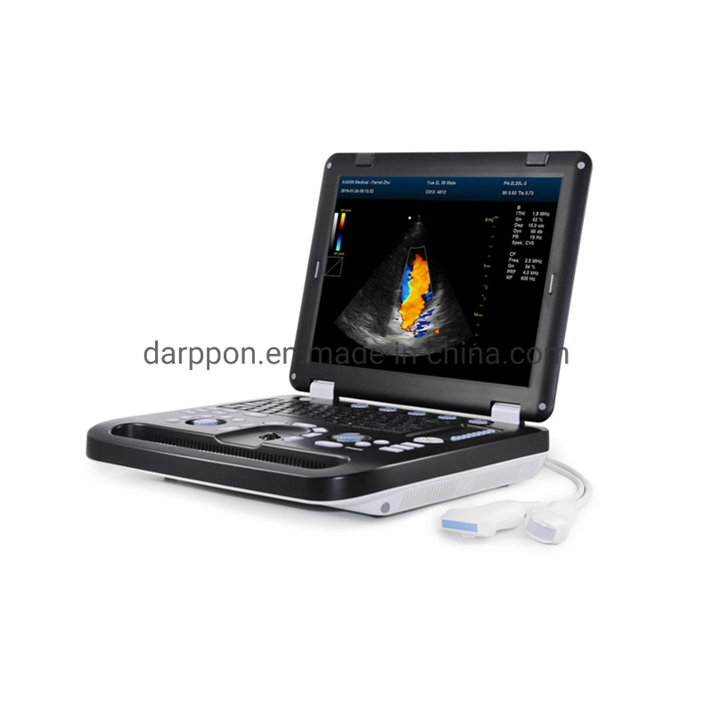 Portable 2D/3D/4D Ultrasound Machine/ Color Doppler Ultrasound Scanner