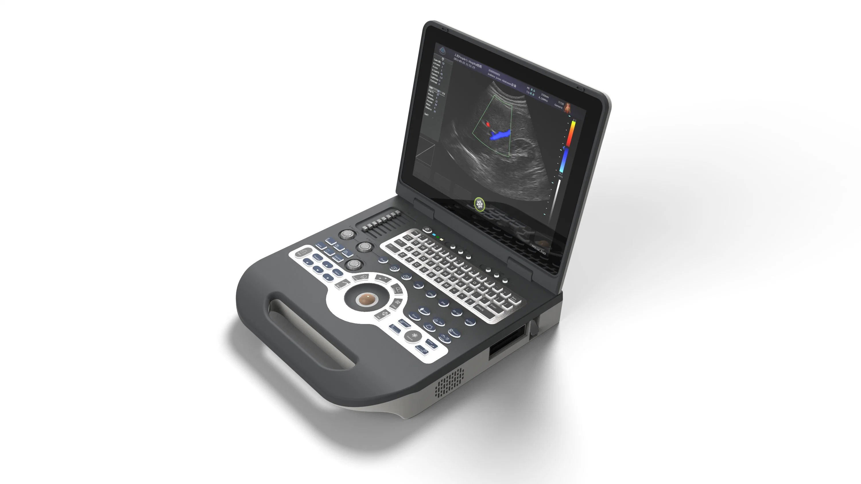 2D/3D/4D Full Digital Laptop Color Doppler Ultrasound Diagnosis System Xf3500