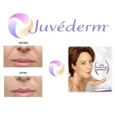Juveder Ultra Plus Fillers for Wrinkles 1ml Lip Filler Ultra2 Ultra3 Ultra4 Hyaluronic Acid Lip Filler Neuramis Injection Stylage Yvoire