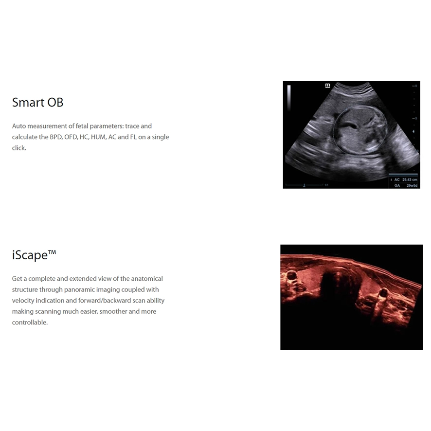 Z60 DP-20 Portable Mindray numérique complet du système de diagnostic du scanner à ultrasons