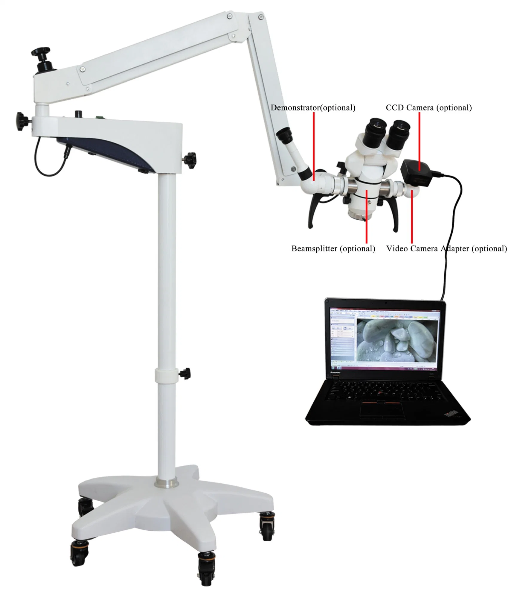 Microscope chirurgical ophtalmique portable avec adaptateur vidéo et moniteur dentaire