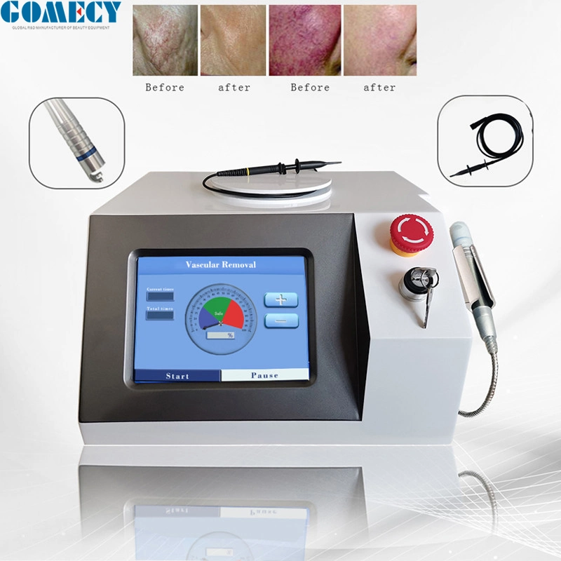 Portable 980nm Laser Vascular Spider Vein Removal Diode Laser Beauty Equipment with 30W