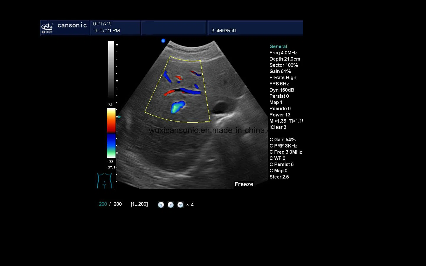 Carrinho para instrumentos médicos 4D Gyn