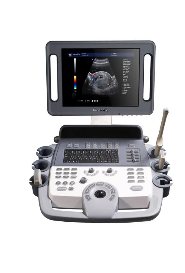 4D Color Doppler Sonograph K10