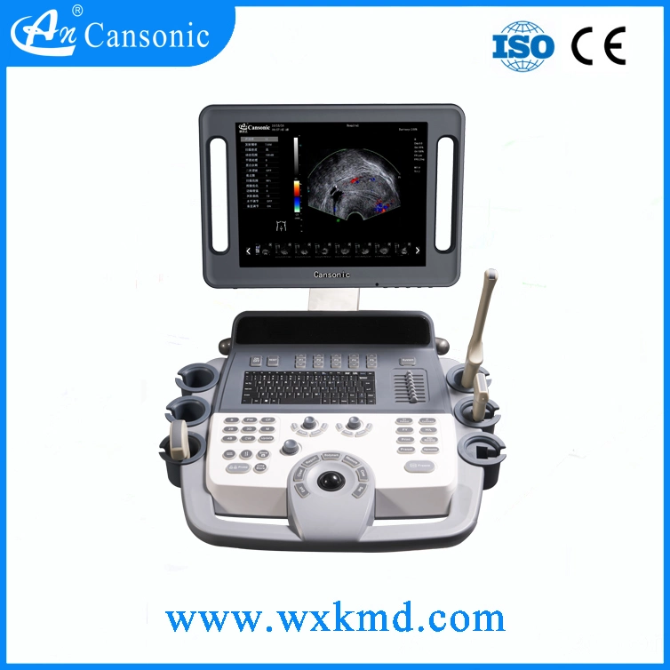 Iclear Image Trolley Color Ultrasonic Mdignostic