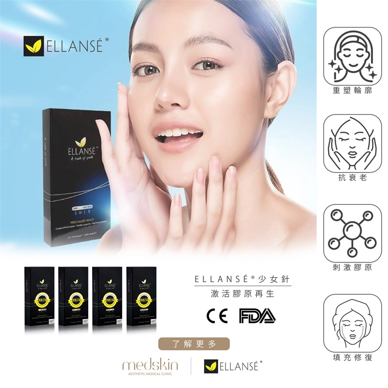 Ellanse Collagen Stimulates Filling Face Hyaluronic Acid Filler Injection Facial Rejuvenation