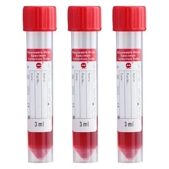 Discount Today Low Price Factory Supply Vtm Kit Virus Sampling Tube with Swab for CE Quality