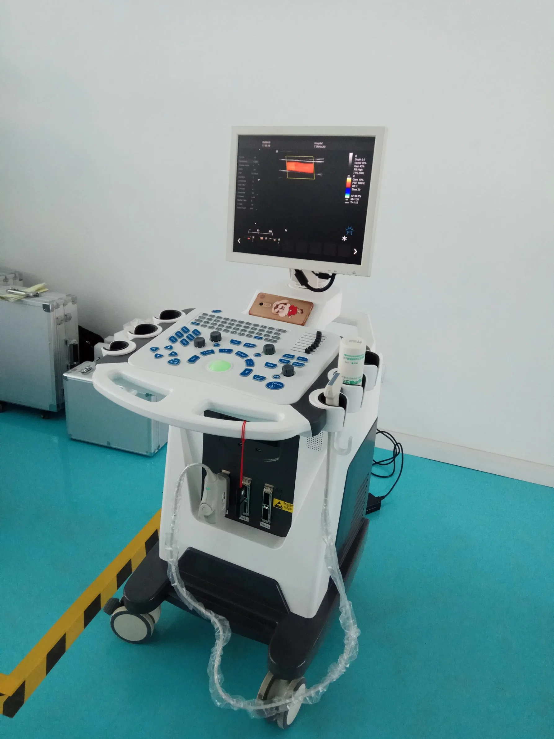Color Doppler Ultrasound Scanner 3D