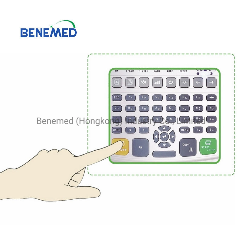 Portable Digital Hospital Equipment 3 Channel ECG Machine