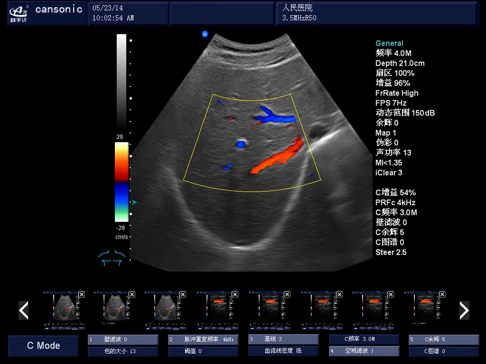 High quality/High cost performance Trolley Ultrasound Scanner (K10)