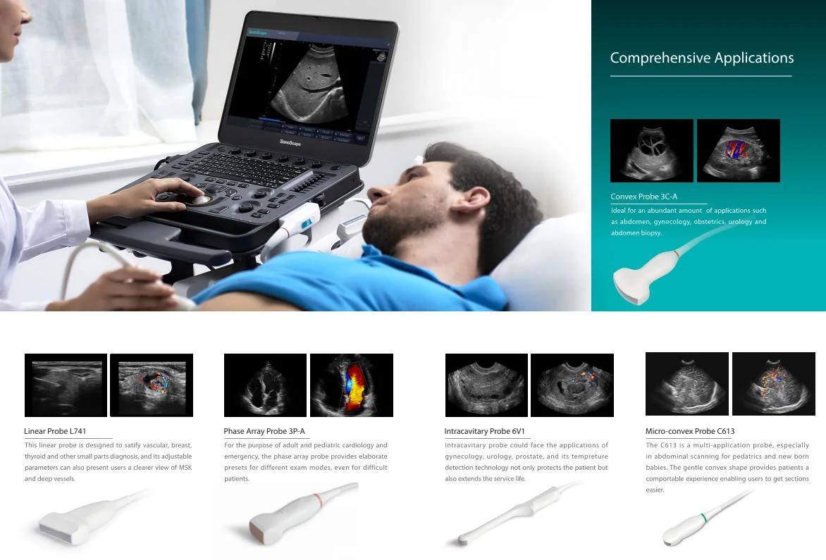 Hospital Laptop Type Sonoscape Advanced X3 High End Portable Cardiac Vascular Thyroid Scan Ultrasound Scanner