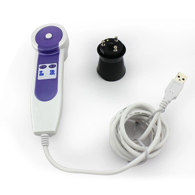 5MP USB Digital Eye Iris Camera for Health Condition Diagnostic