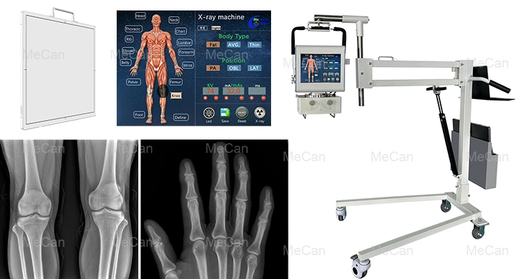 X Ray Equipment Patient Portable X-ray Machine for Hospital