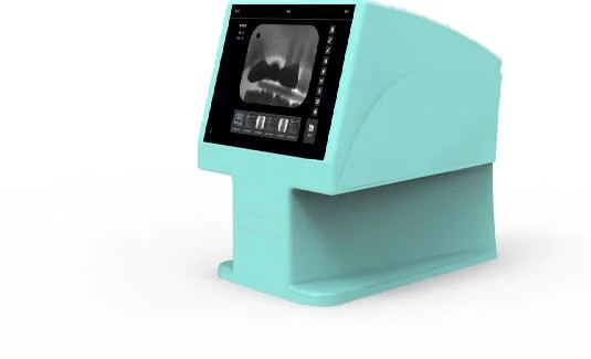 Dental Imaging Phosphor Plate Scanner Digitalized Dental Intraoral Imaging