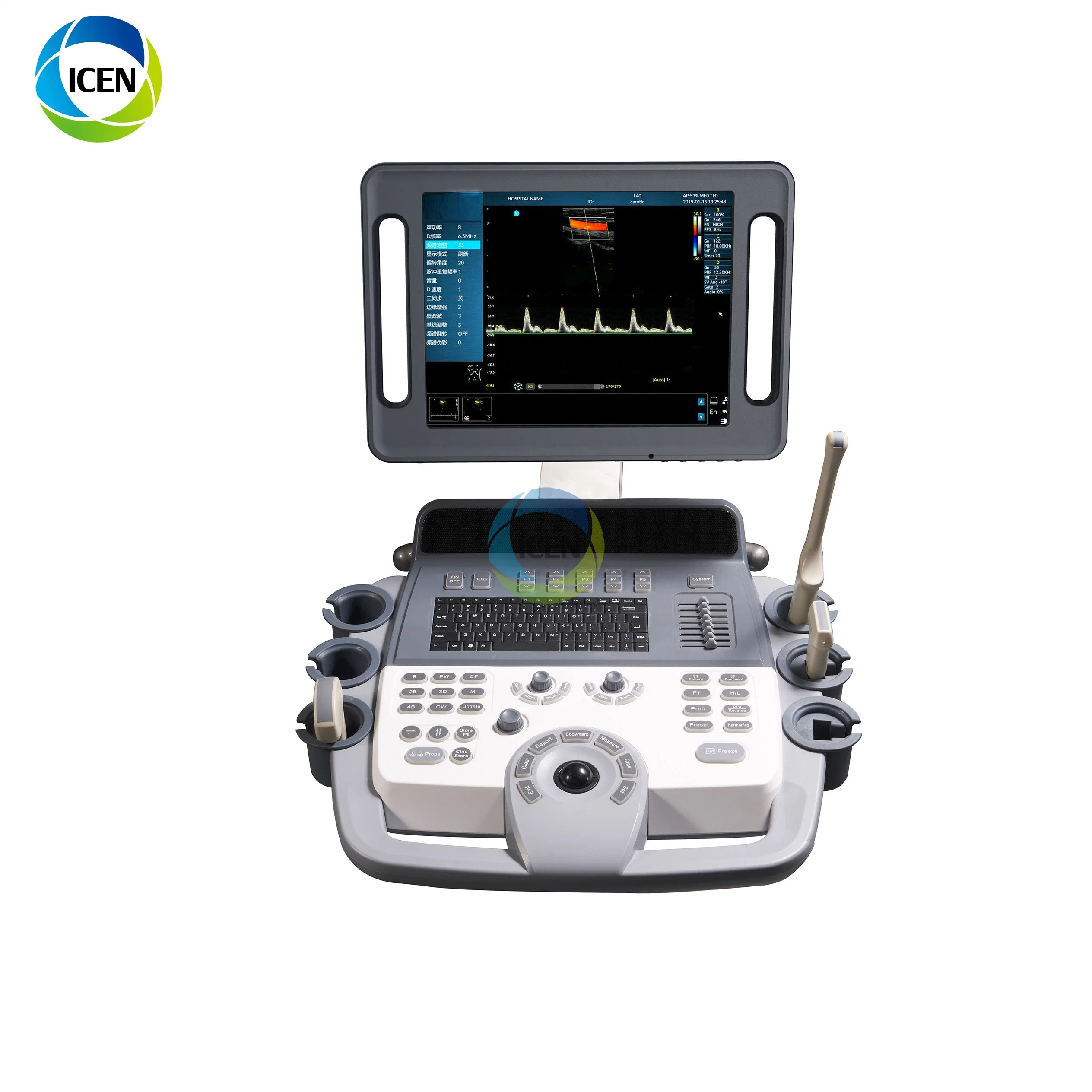 IN-AK12 united ultrasound laptop ultrasound machine color doppler product