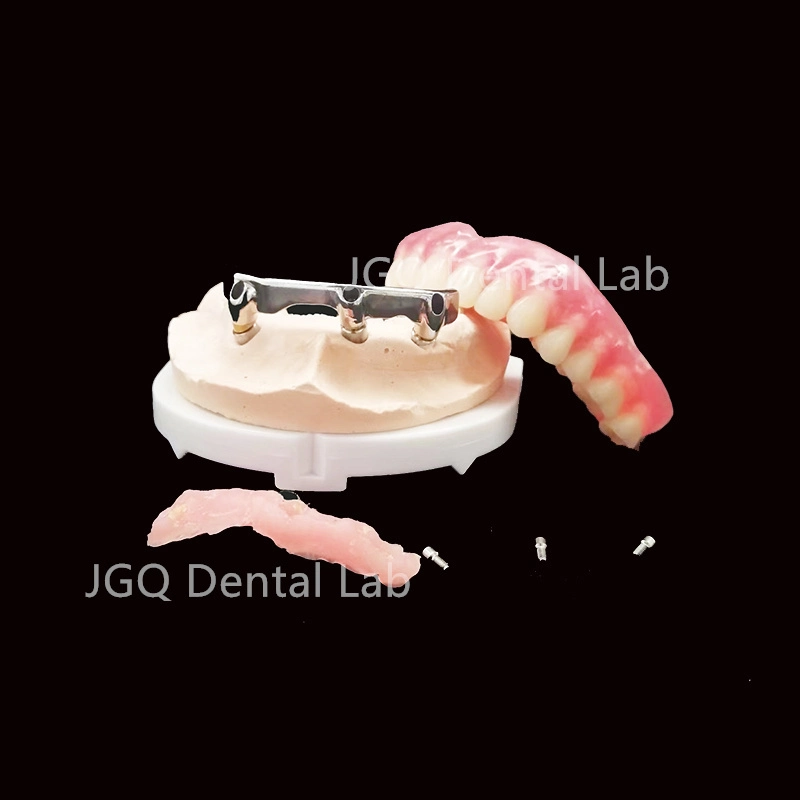 China Dental Lab Custom Quality Alle auf 4 Implantat Bar Reines Titanmaterial
