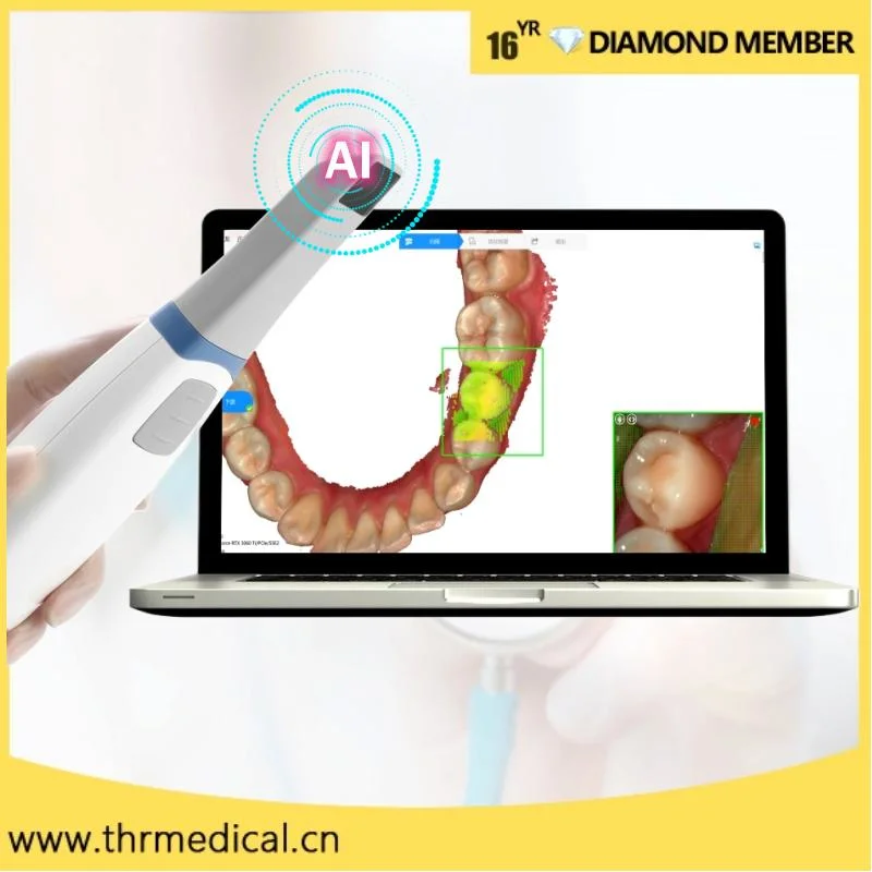 L'équipement dentaire intraoral dentaire numérique en 3D scanner orale meilleur Intraoral orale Caméra (thr-IC01)