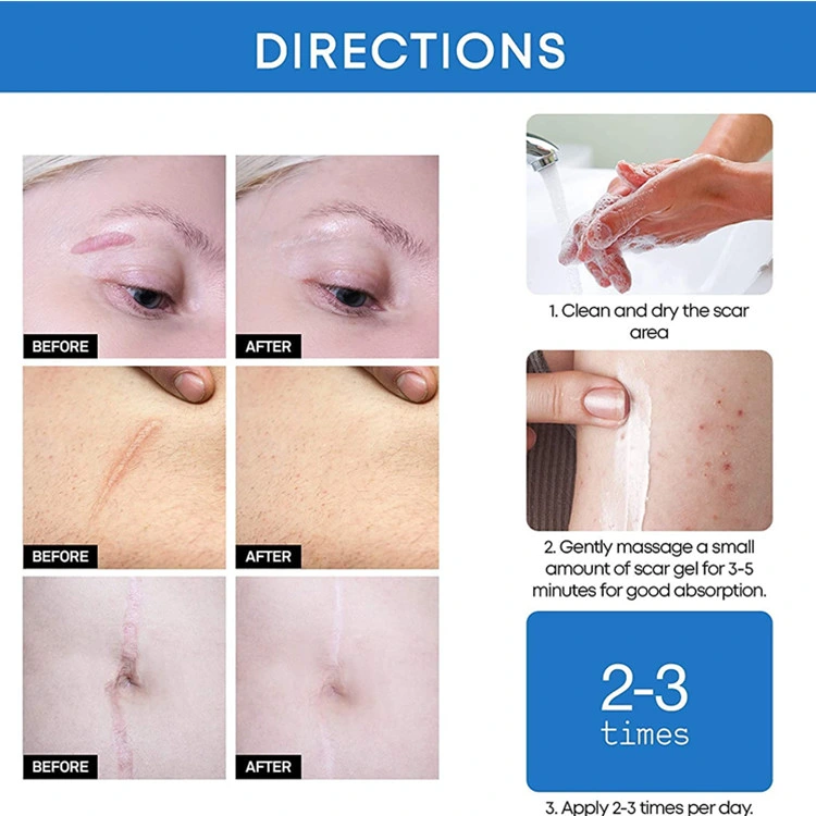 OEM Cosmetics Custom Advanced Silicone Scar Removal Gel for Face