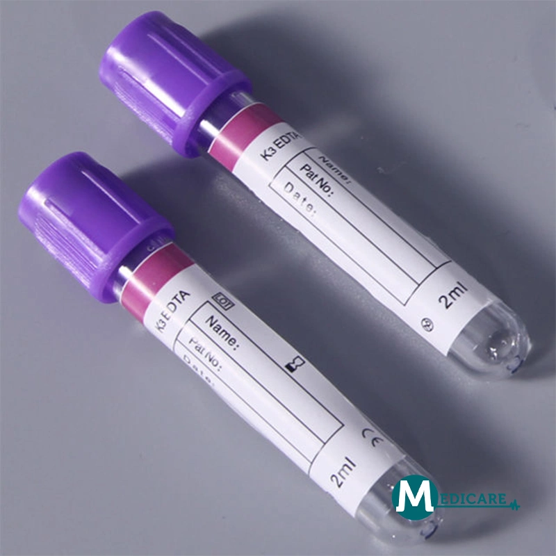 Best Selling Hospital Medical Supplies Disposable Vacuum Blood Collection Tube