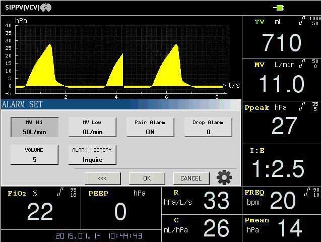 El mejor Hospital utiliza el ventilador de la ICU de gama alta.