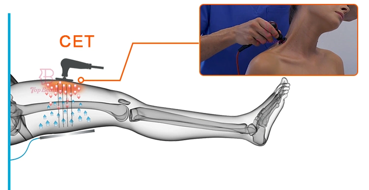 Recuperación del dolor Tecar 448Hz máquina de terapia Ret y CET manijas Alivio del dolor Winback máquina Tecar