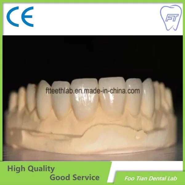 Material dentário coroa de Suprimentos Laboratório Dental Produtos Ortodontia ultra naturais folheados finos para sorriso perfeito
