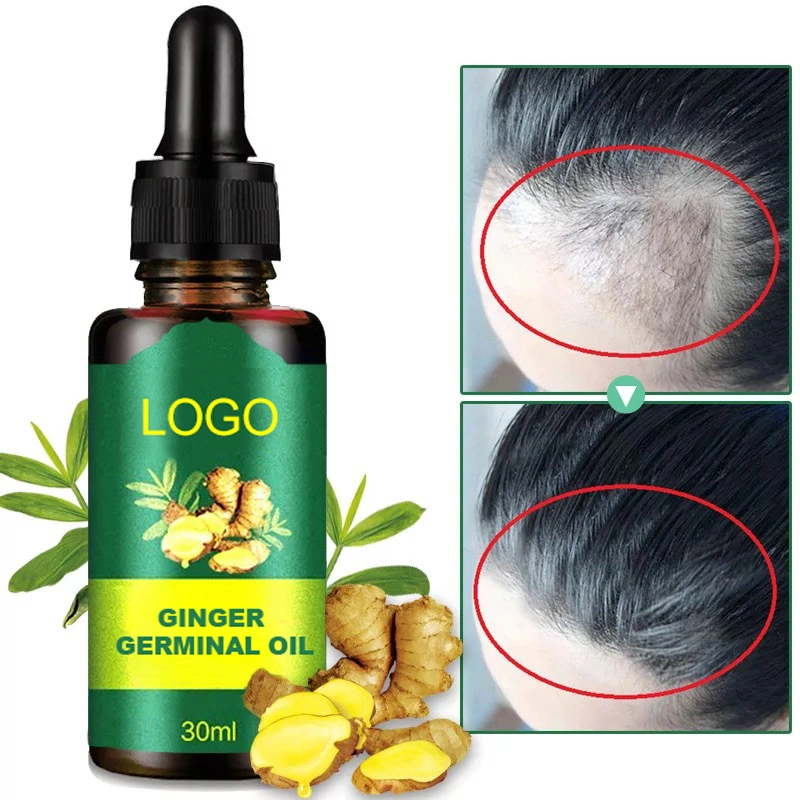 Hot Sale 30ml La perte de cheveux de la croissance de traitement de l'Essence d'Argan Gingembre organiques naturels d'huile de la croissance des cheveux de l'huile de cheveux pour l'Homme Femme