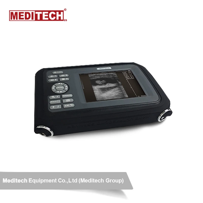 Tragbarer Ultraschallscanner Für Die Medizinische Diagnostik