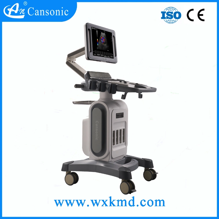 Trolley Ultrasound Scanner in Wuxi Cansonic