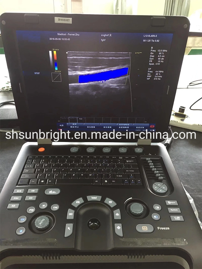 CF+B Pw Cw Function Color Doppler Ultrasound Scanner with Ce