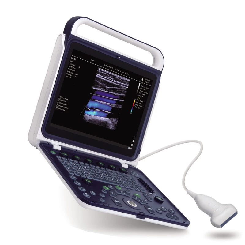 Mon-A027e l'équipement de diagnostic médical de l'abdomen de l'Urologie échographe portable portable