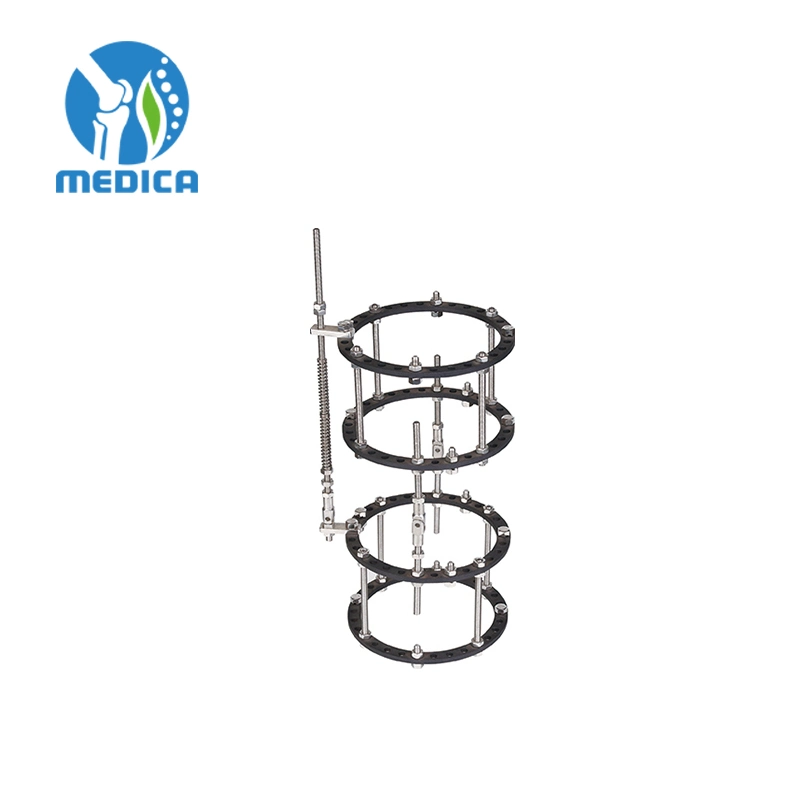 Trauma orthopédique coude joint anneau type structure combinaison fixation externe Fixateur de coude