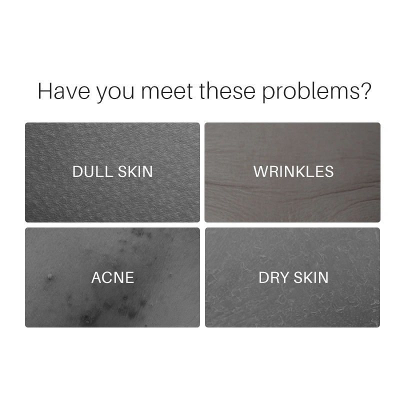 Beleza cosméticos cuidados da pele a moisturização reduz o ácido Acne Azelaic 10% Soro facial