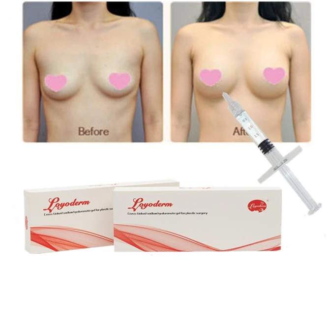 Injectable Breast Filling Hyaluronic Acid Ha Filler Dermal Filler