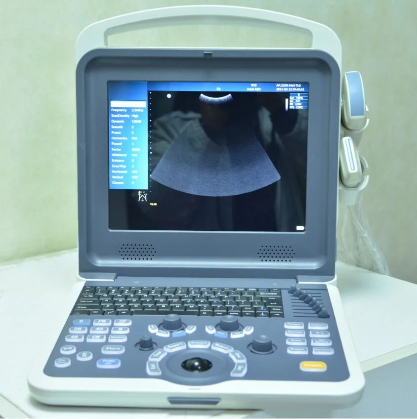 Portable Color Doppler Ultrasound Scanner 128 Elements