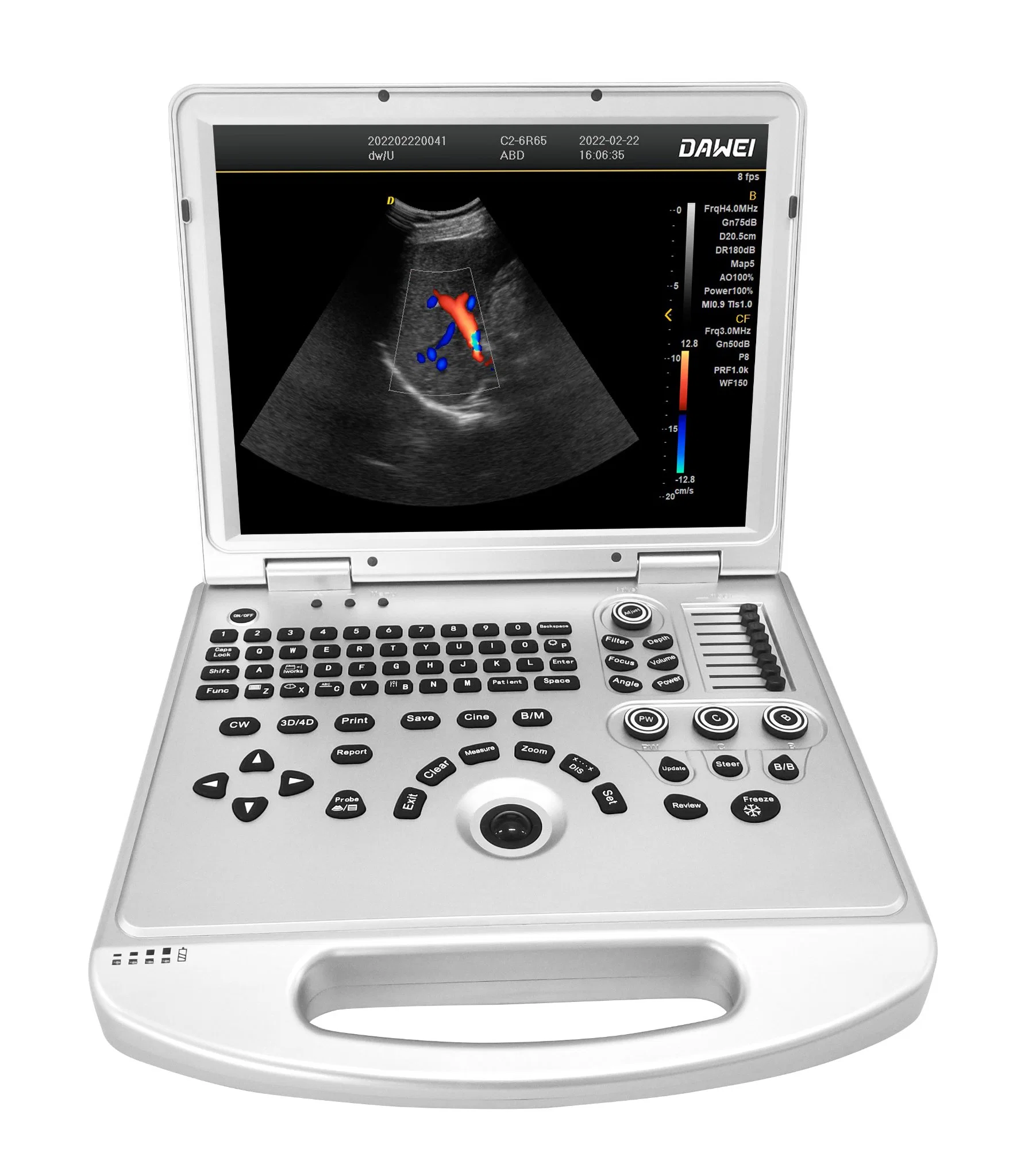 Ordinateur portable L'échographie Doppler avec fonction de l'image PW