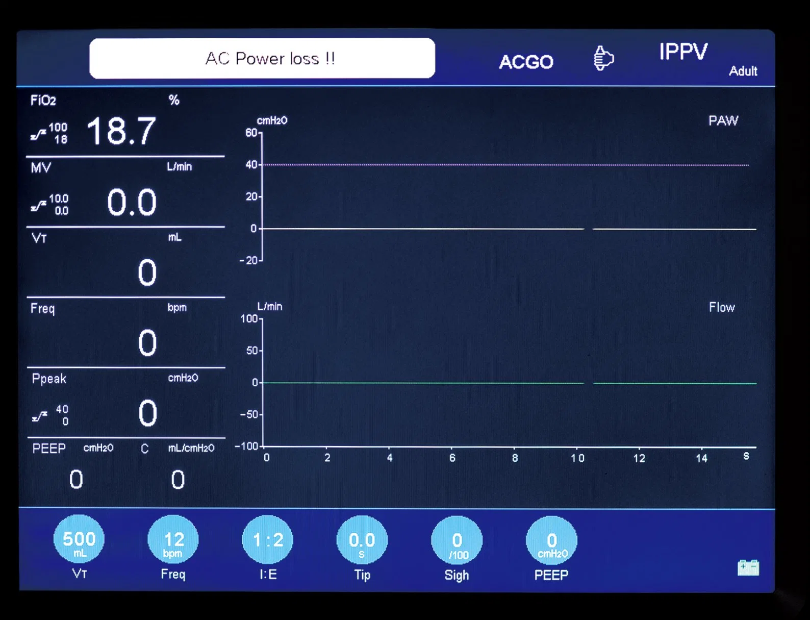 Hospital Use Portable Anesthesia Machine Price with Ventilator CE/ISO