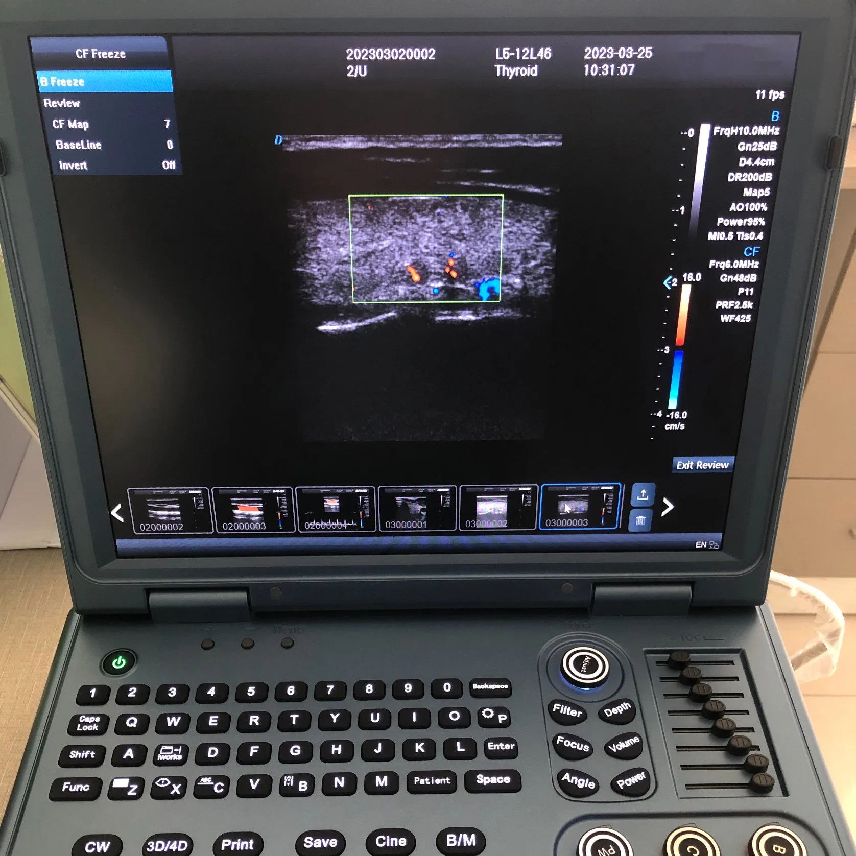 Nuevo tipo de medicina Doppler Color portátil portátil del Sistema de Diagnóstico por Ultrasonidos con batería recargable