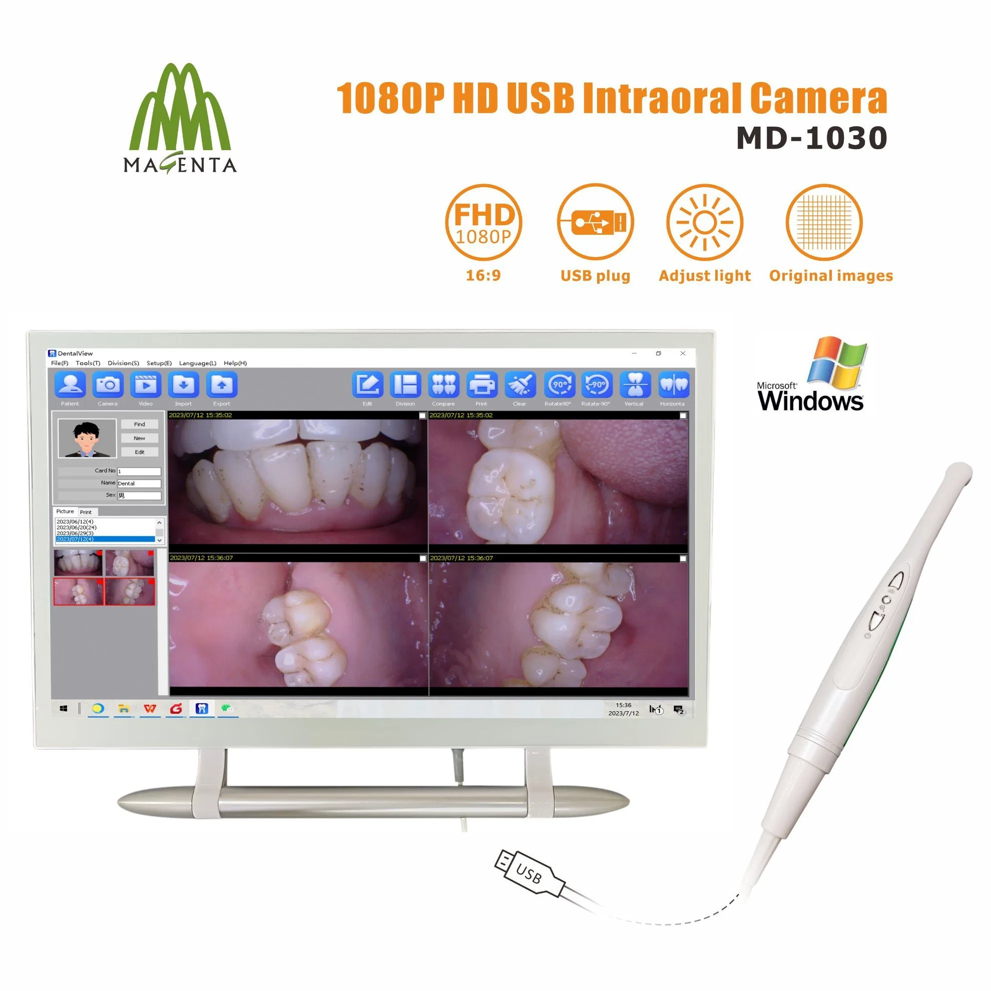 Magenta 2023 USB Wire 1080P Intraoral Camera Factory Wholesale/Supplier Price Support Twain
