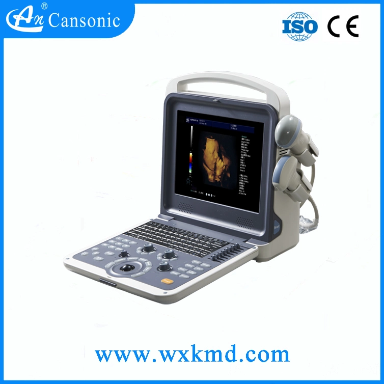 Super Laptop Ultrasound Scanner (K2)