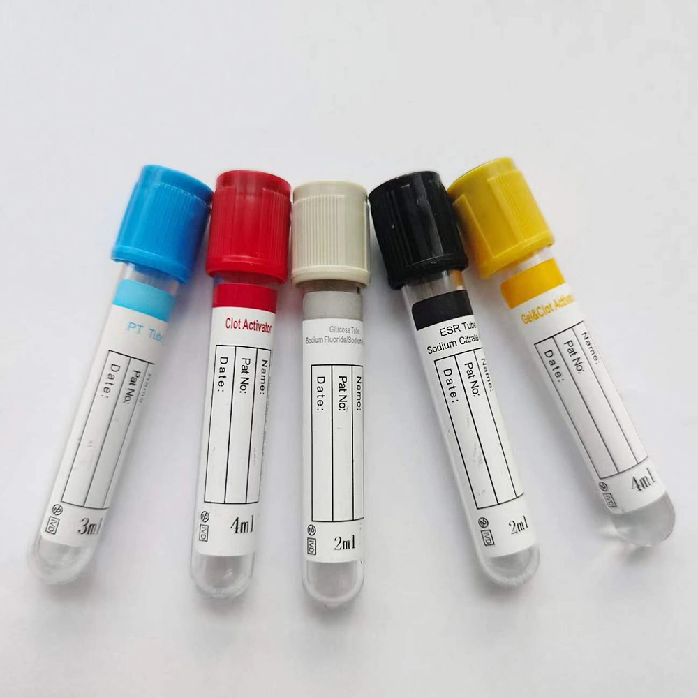 Factory Supply Different Types of Vacutainers Vacuum Blood Collection Tube Blood Collecting Tube with CE ISO