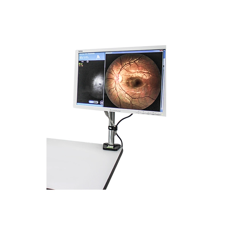 SY-V036A Equipo oftálmico de alta calidad Cámara Digital Eye Auto Fundus Para el hospital