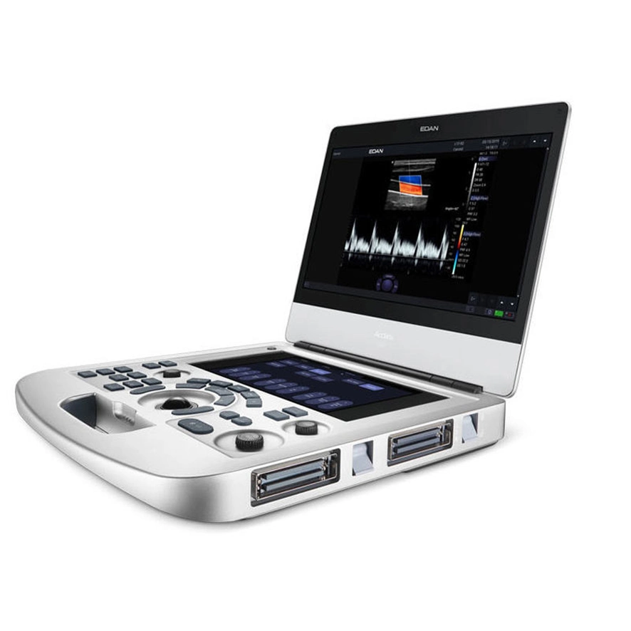 Ax3 Medical Acclarix AX4 POC Edan portátil Doppler Color Ultrasound Equipo médico