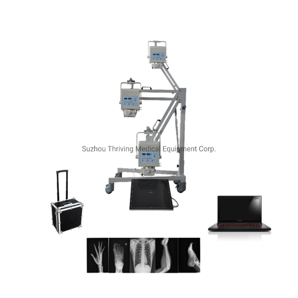 جهاز الأشعة السينية المحمول الصغير عالي التردد رباعي الكيرووات رقمي طبي مع نظام DR (thr-XR-4KW)