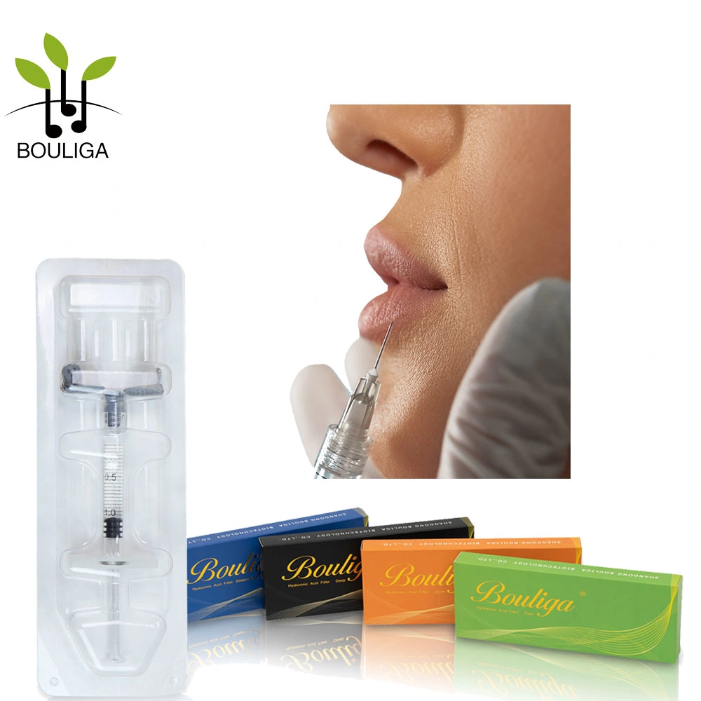 Bouliga Dermal Filler 1ml Lip Filler for a Natural-Looking Result