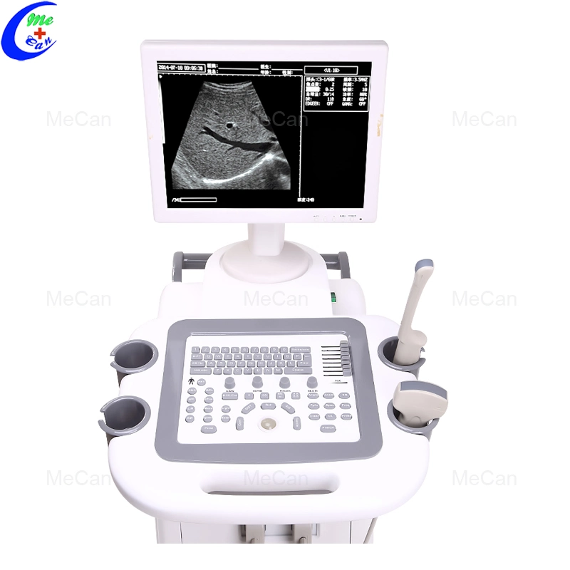 14 Inch Full Digital Trolley Ultrasound Scanner