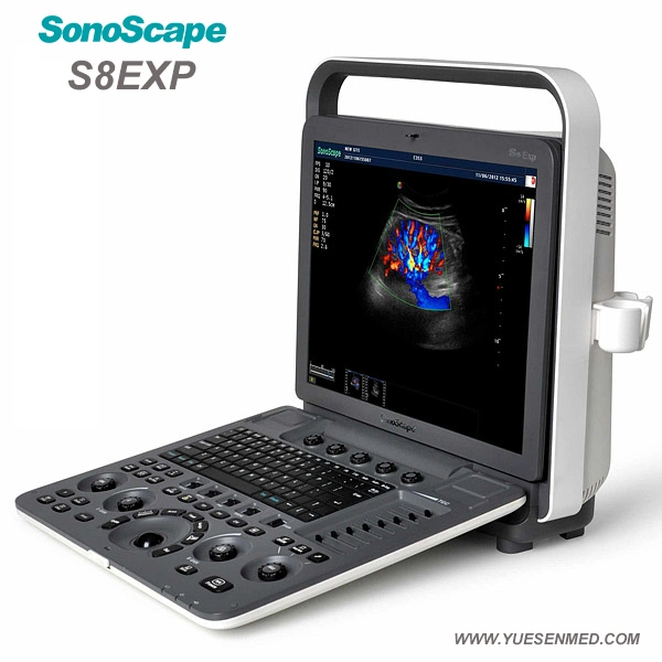 Medical Sonoscape S8exp máquina de ultrasonido Escáner portátil barato