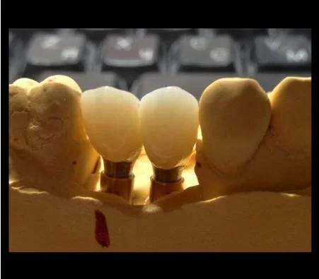 Personalizable multicapa 3D Pro Zirconia Dental estética Material Resteration disco